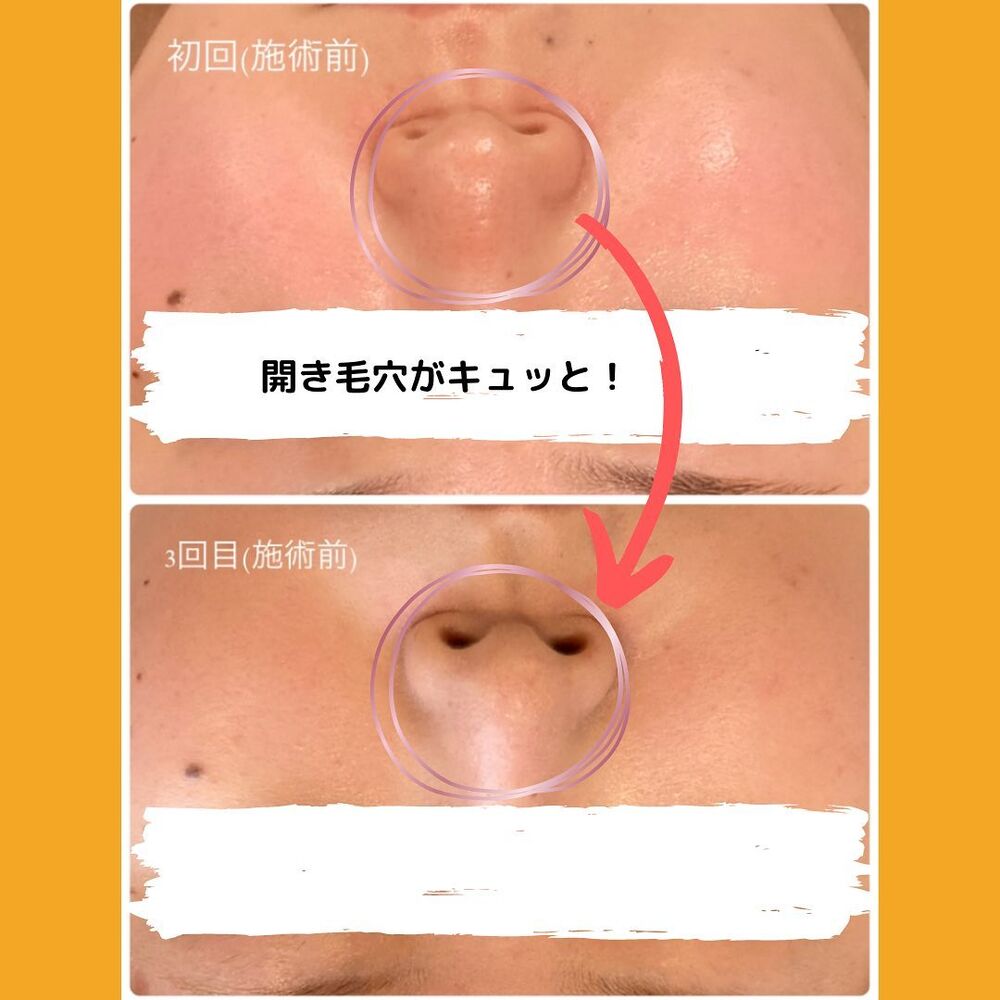 画像1316