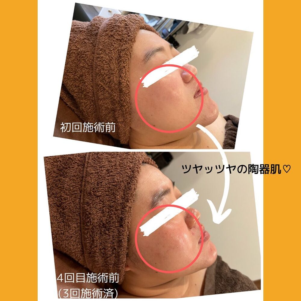 画像1355